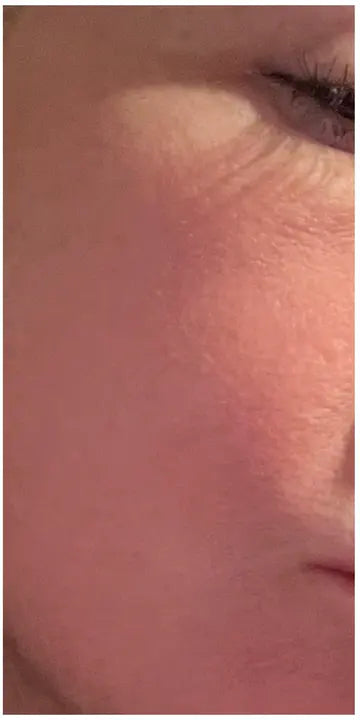 After — Sarah T., 34