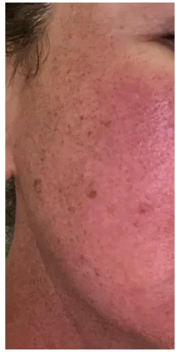 Before — Sarah T., 34