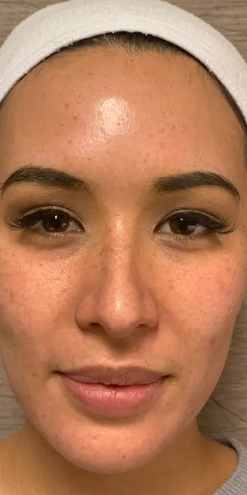 Before — Jessica L., 29