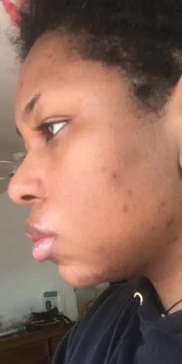 Before — Michelle R., 41