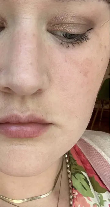 After — Amanda K., 27