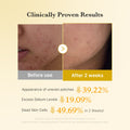 Source clinical-results creative showing skin before use and after two weeks