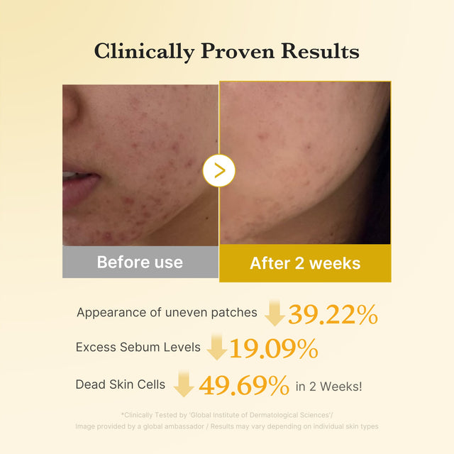 Source clinical-results creative showing skin before use and after two weeks