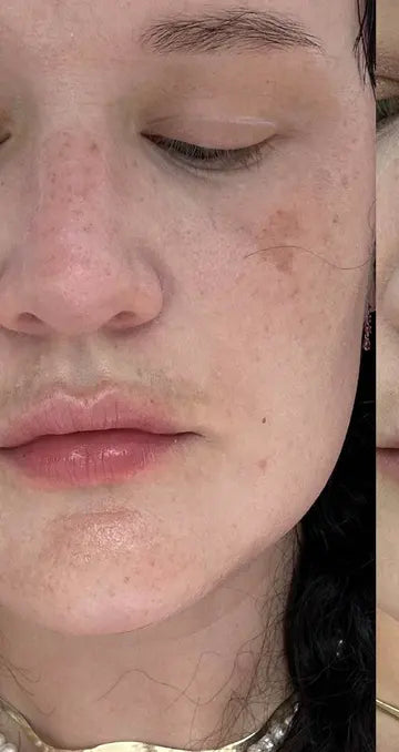 Before — Amanda K., 27