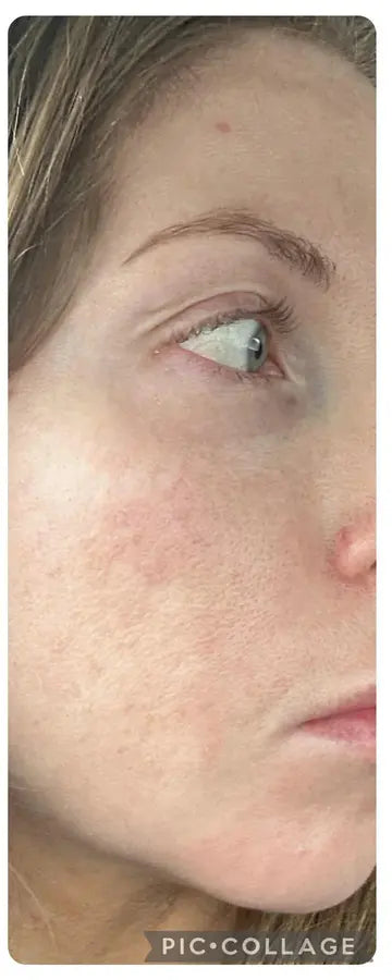 After — Danielle P., 35