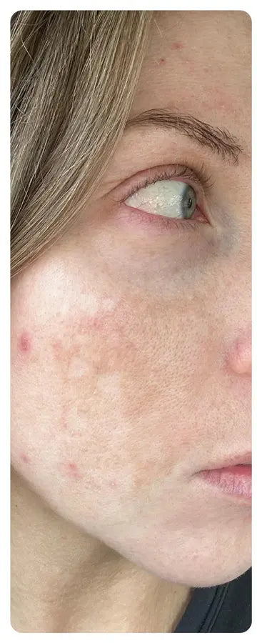 Before — Danielle P., 35
